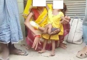 Aneh! Tubuh Balita Ini Tumbuh Dua Lengan dan Kaki di Perut