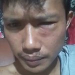 Foto wajah korban yang mengalami bengkak-bengkak di wajahnya.